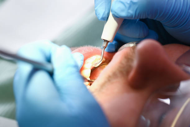 Best Urgent Care for Lost Fillings or Crowns in Moorhead, MN