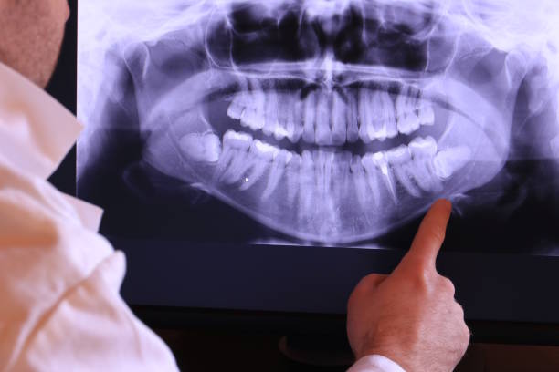 Best Emergency Gum Treatment in Moorhead, MN