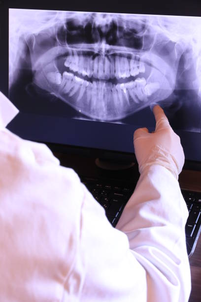 Best Emergency Denture Repair in Moorhead, MN